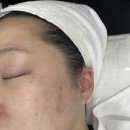 클라씨 - 강서구 | 마곡여드름관리 트러블피부관리 전문 클라씨 방문 후기
