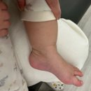 H6640 | [제로이드MD 크림] 현대해상 실비 청구 후기(25.3.26 기준)