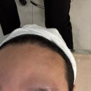 미소유 에스테틱 | 구리여드름관리 미소유에스테틱 여드름압출, 데콜테 후기