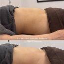오로나뷰티 | [광주 산후복부관리] 출산 후 처진 뱃살, 오로 배출 돕는 1:1 맞춤 케어 후기