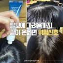 우수수 | "비듬? 두피각질? 모발 우수수 떨어질 때..." 솔랩 탈모앰플 두피앰플 후기