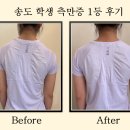 [송도측만증] AI시대 척추측만증 자세교정 체형교정 송도필라테스 1등 헤이제이필라테스