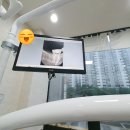 치아(이빨) 찌릿해서 신경치료한 후기! 이가 깨졌어요 + 구리 치과 추천 서울바른e치과
