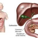 간암 및 간경화의 현대의학적 치료와 통합의학적 치료 그리고 자연치유에 관하여 이미지