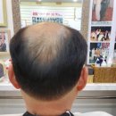 셀모가발 이미지