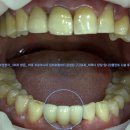 덴탈아트치과기공소 이미지