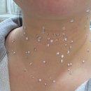 시민의원 | 부천 타임의원 레이저치료 주말 웨이팅 방문후기