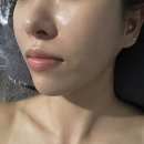 더팔페이션 | 송파 피부관리 초페리 윤곽관리 후기