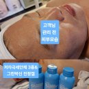 우리 삶에 정말 중요한 피부관리 (제로파데) 이미지