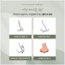 수쁠리