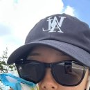 무지개약국 | 눈밑지(눈밑지방재배치) + 지방이식 6개월차 솔직 후기｜내돈내산 (광고·협찬 X)