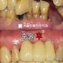 서울민플란트치과의원 이미지