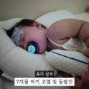 38℃ | 7개월 아기 고열 돌발진 후기 면역력 저하와 해열제 교차복용 정리