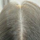 그로우모모 두피 탈모 케어센터 이미지