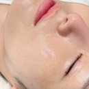 백설공주 | 군자 피부관리 바나나부띠끄 백설공주케어 솔직후기
