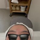 아이버 | 아이버츄(Virtue RF) 고주파 리프팅 내돈내산 솔직 후기 | 이상한 광고 아님, 아쉬운 점