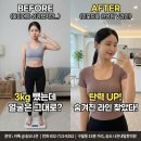 713 | [인천 구월동 인모드] "3kg 뺐는데 얼굴은 그대로인가요?" 살이 아니라 '탄력'이 늘어진 겁니다.