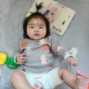 새솔외과의원 | 아기 엉덩이 화상 / 6개월 아기 수원 화상전문병원 새솔외과의원 입원한 후기