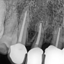 종로크라운 이미지