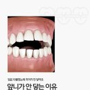 범어스카이치과교정과치과의원 | 앞니가 안 닿는 이유 - 대구교정치과