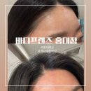 홍익로 11 프리스비빌딩 앞 | [뷰티프렌즈 홍대점] 홍대왁싱헤어라인&amp;이마왁싱