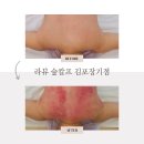 김포장기한의원 | 김포 장기동 라뷰숲칼프 전신 바디 관리 등 관리 피부 관리 온열 돔 풀케어 가능한 곳 찐 후기
