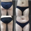 멍팔상팔 | [다이어트] #팔 #복부 #허벅지 #무한람스후기