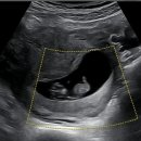 케이씨엠 KCM 이미지