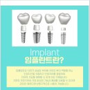 덴탈스케치치과기공소 | 안산치과후기 임플란트 선택으로 상실 걱정없게