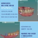 다치과기공소 네이버블로그
