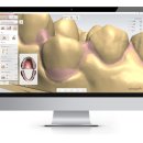 솔루션치과기공소 이미지