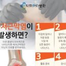 족저근막염 발바닥 통증 증상 운동 스트레칭 신발로 해결될까? 이미지