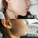운정역에스테틱 추천 비엔비스파에스테틱 재방문 후기