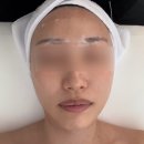 인북로 | 익산피부관리 정든에스테틱 임산부도 가능한 리턴에이징 후기