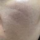 큐브 케어 | 내돈내산 보탬큐브N 한달사용기(2탄 3회차) 비대칭 탄력 케어 후기