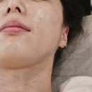 덕진한방병원 | 전주 피부관리 청담한방병원 청담스킨케어 물광초음파 소노케어 후기