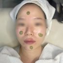 향기나스킨케어 | 안양 범계에스테틱 디또뷰티 (구)유리나스킨 레드벨벳 홍조 케어 추천 후기