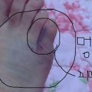 [우린하나이니까] 발붕대푼짤이야.. 이때발씻고찍ㅇ엇어.. 무신ㄴㄴㄴㄴ해.. 이미지