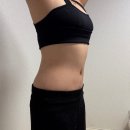 11545-03-35-08 | 강남 유명 성형외과에서 복부지방흡입, 가격부터 당일·3개월차 변화까지