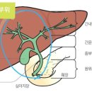 담도암의 원인과 치료 과정 그리고 성공과 실패 사례에 관하여 이미지