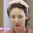 베스트메디필 네이버블로그