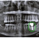 이수치과기공소 이미지