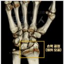 낙상창고 이미지