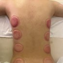 유경더뷰티 - 사하구 사리로46번길 12 | 괴정바디관리 유경더뷰티 에르고핏 허리 등군살 정리 후기