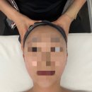 아쿠아플러스 남대구점 | [대구] 라플러스에스떼 - 남구 대명동 피부관리/물광 작은 얼굴 효과 솔직후기 (아쿠아필&amp;물방울리프팅)