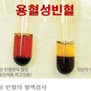 뼈 건강 세미나 - 암 치료 환자와 심장기능 이미지