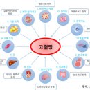 당뇨 90%는 ‘2형 당뇨’…40세 이전 발병 증가 추세 이미지