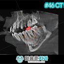 은천동-42 네이버블로그