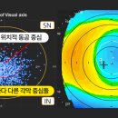 노바의원 네이버블로그