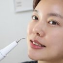 스탠다드치과 | 셀프 치석제거기 후기 안전한 윈웨이 치아관리법